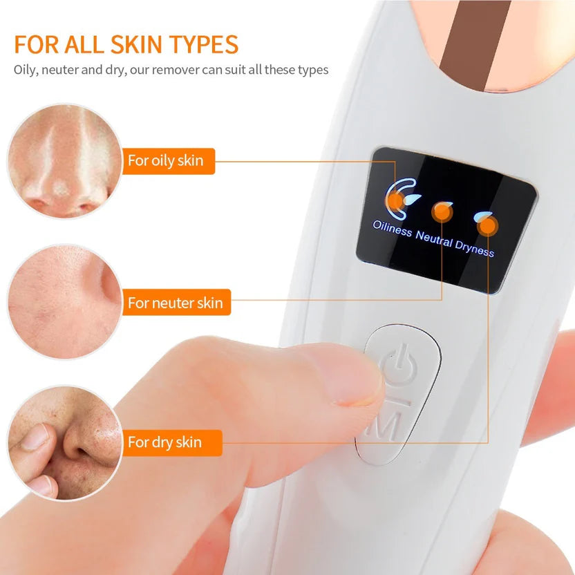 5-in-1 Acne & Blackhead Remover