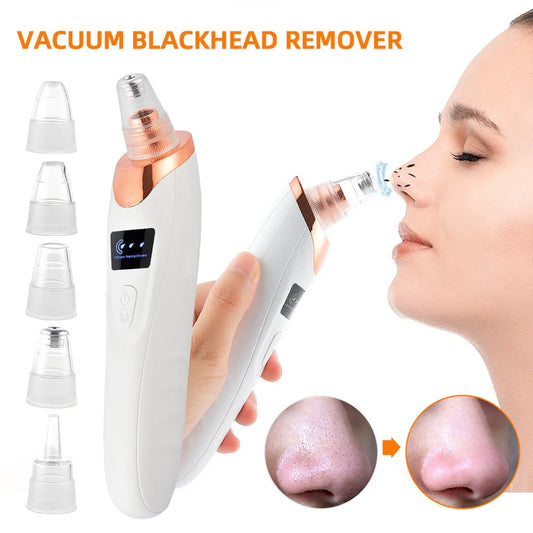 5-in-1 Acne & Blackhead Remover